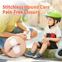 Load image into Gallery viewer, MME™ Stitchless Wound Closure Kit