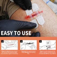 Load image into Gallery viewer, MME™ Stitchless Wound Closure Kit