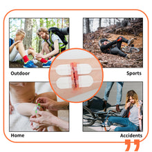 Load image into Gallery viewer, MME™ Stitchless Wound Closure Kit